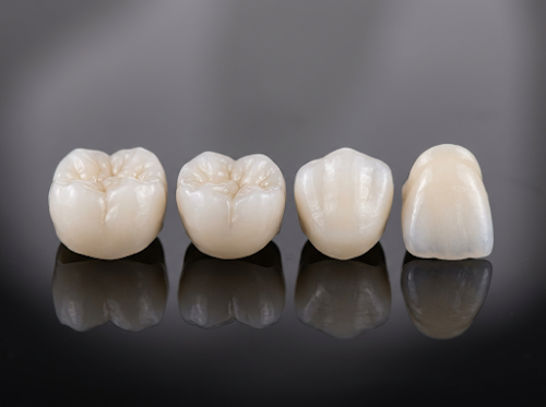 セラミック被せ物