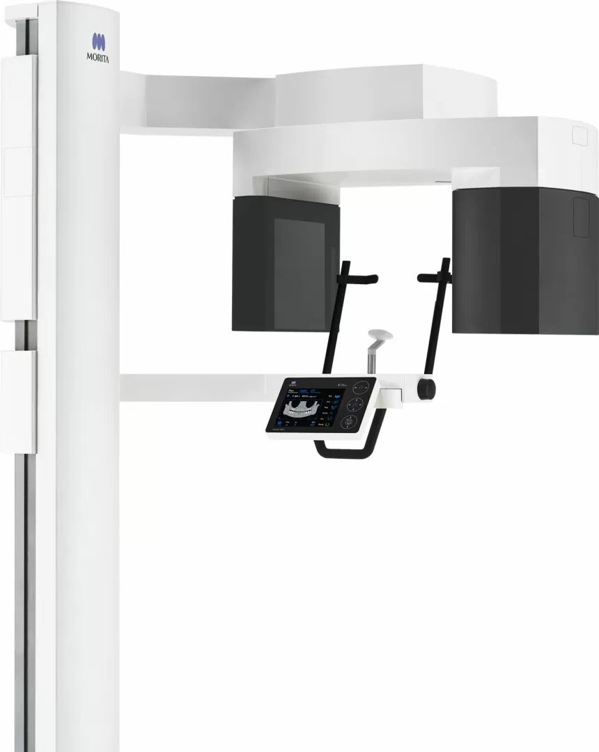 コーンビームCT